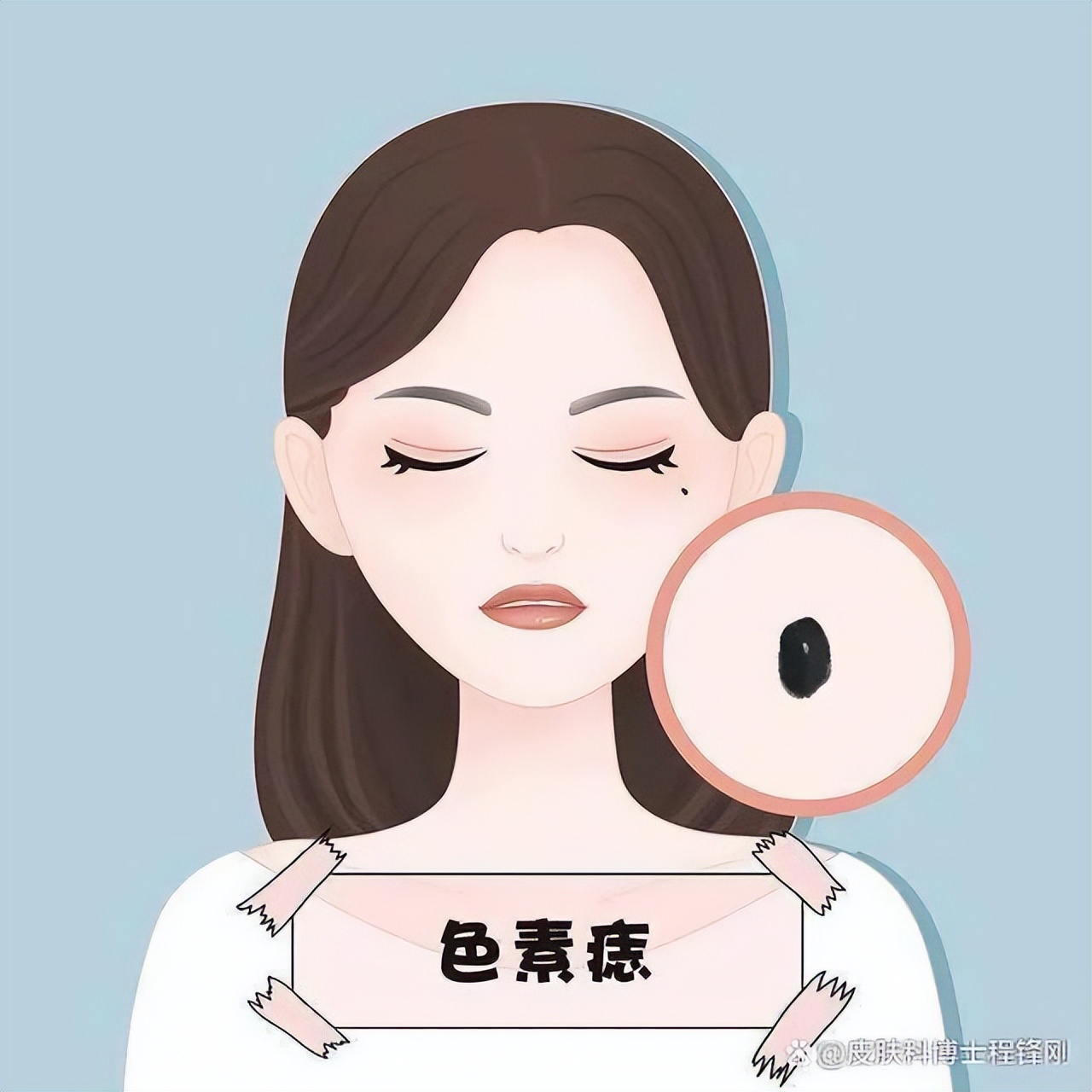 祛痣不长毛了,祛痣祛不掉