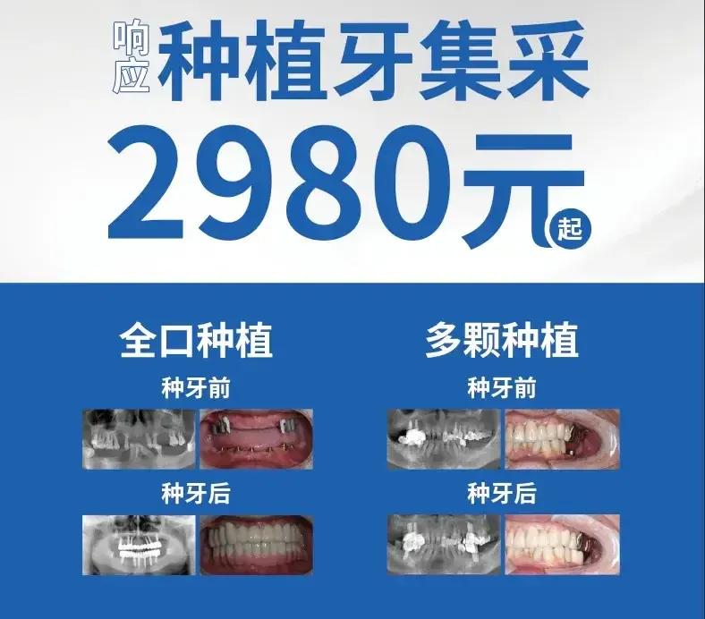 种牙补牙属于什么行业,牙科以后几十年发展会怎么样