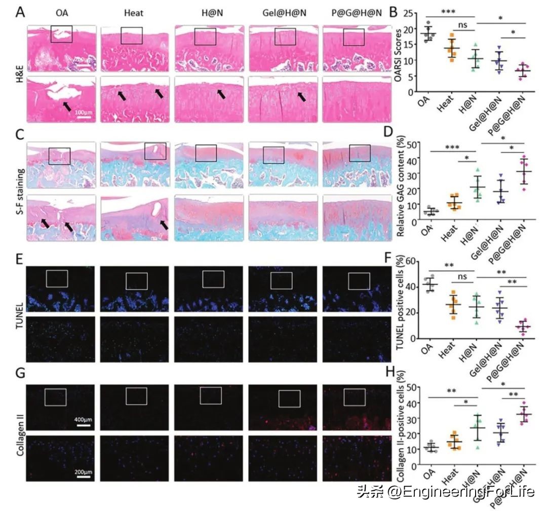 妙！微球嵌微针，一篇AFM