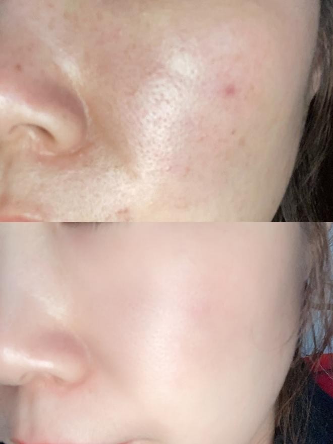 叶酸护肤品有刺激吗,孕妈可以用叶酸类护肤品吗