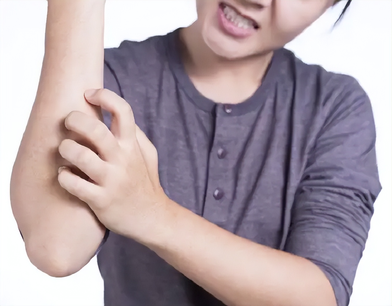 炉甘石洗剂搭配什么祛痘,炉甘石洗剂能用在哪些皮肤病