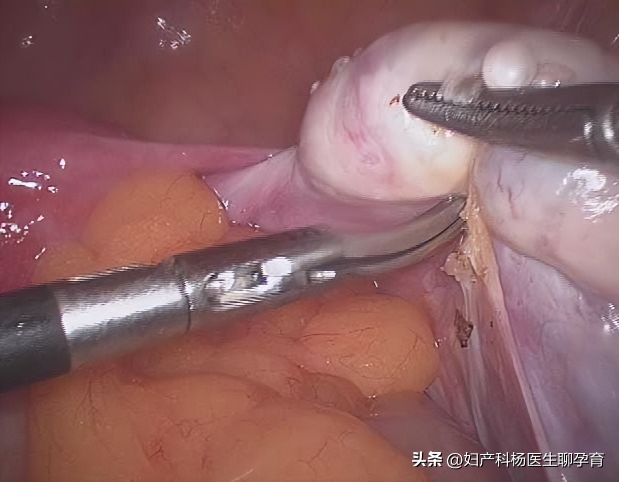 继发性闭经要怎么治疗,护考原发性闭经和继发性闭经区别