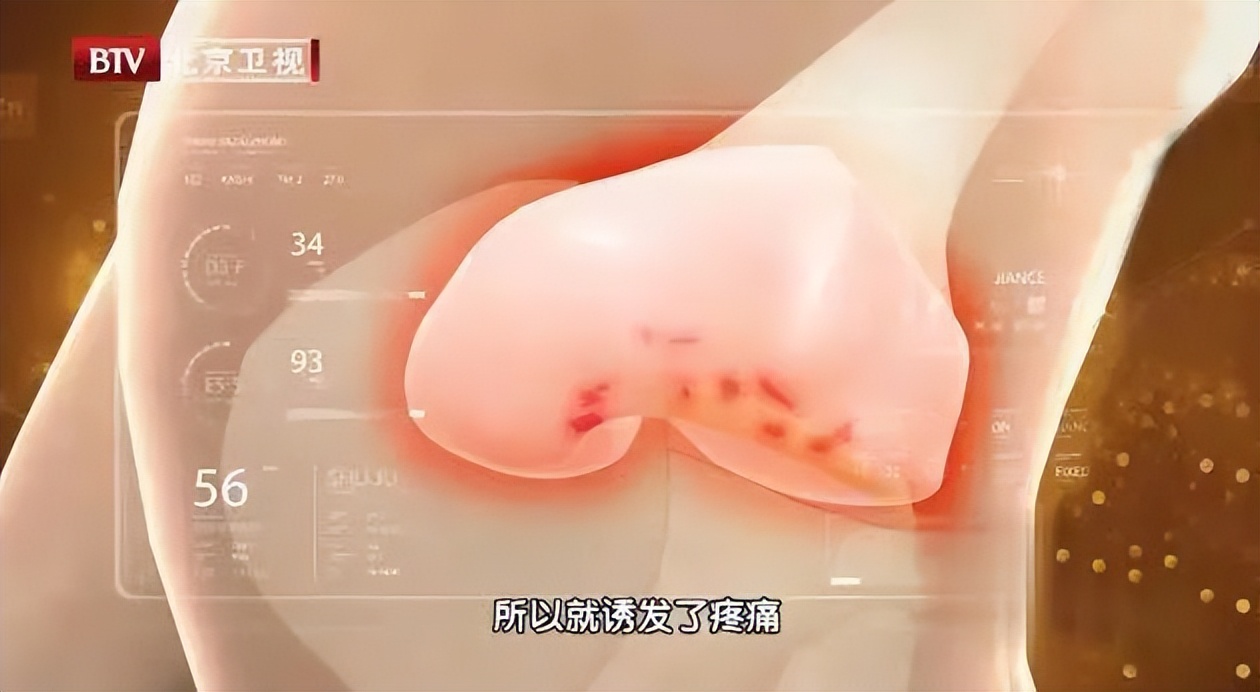 来势汹汹的甲流到底是什么,甲流来势汹汹专家教你科学应对