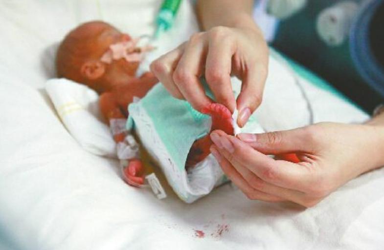 山东24岁女子诞下五胞胎,泰安24岁女子产下五胞胎多少斤