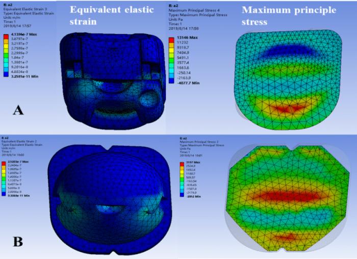 球托牙套,牙套很容易掉怎么办