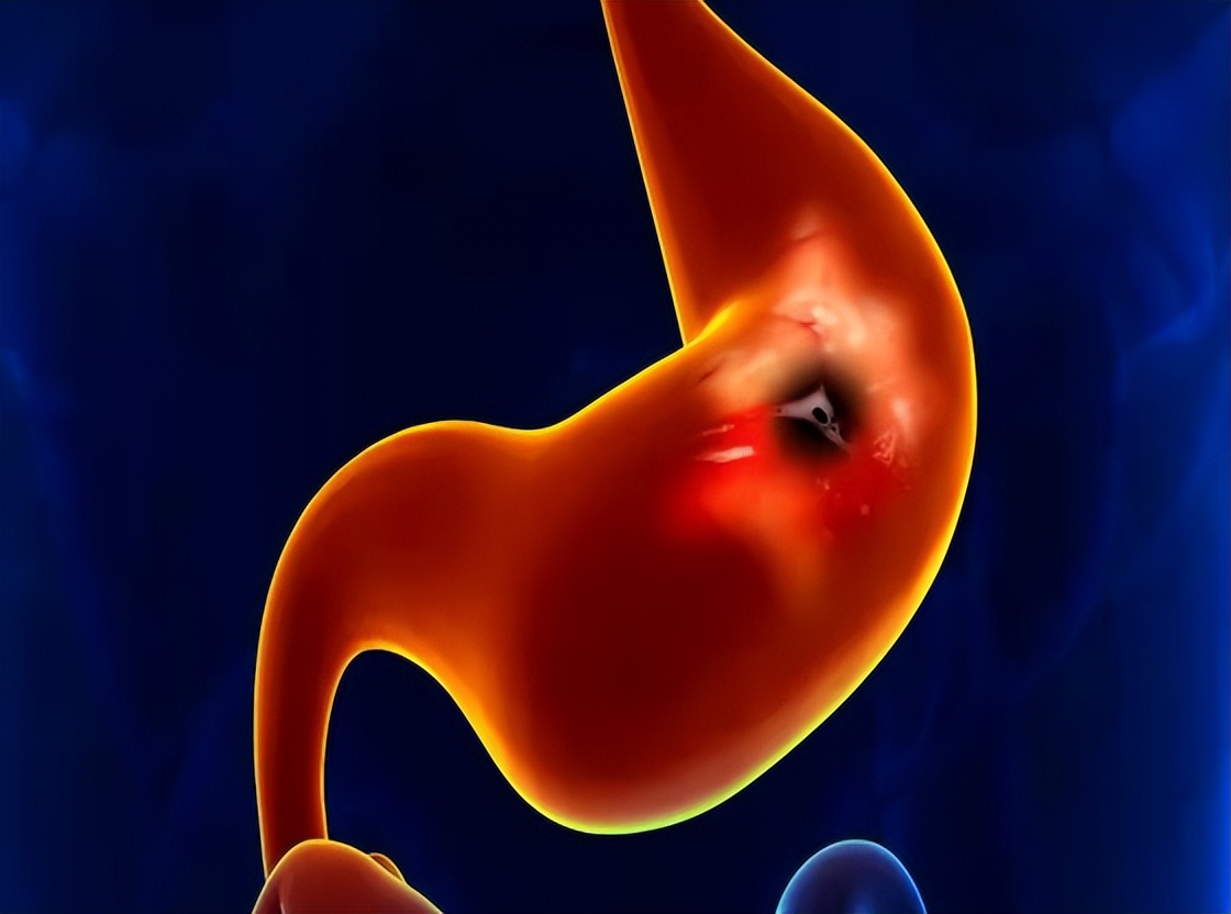 肛门瘙痒潮湿是什么原因怎么治疗,肛门周围潮湿又痒怎么治疗