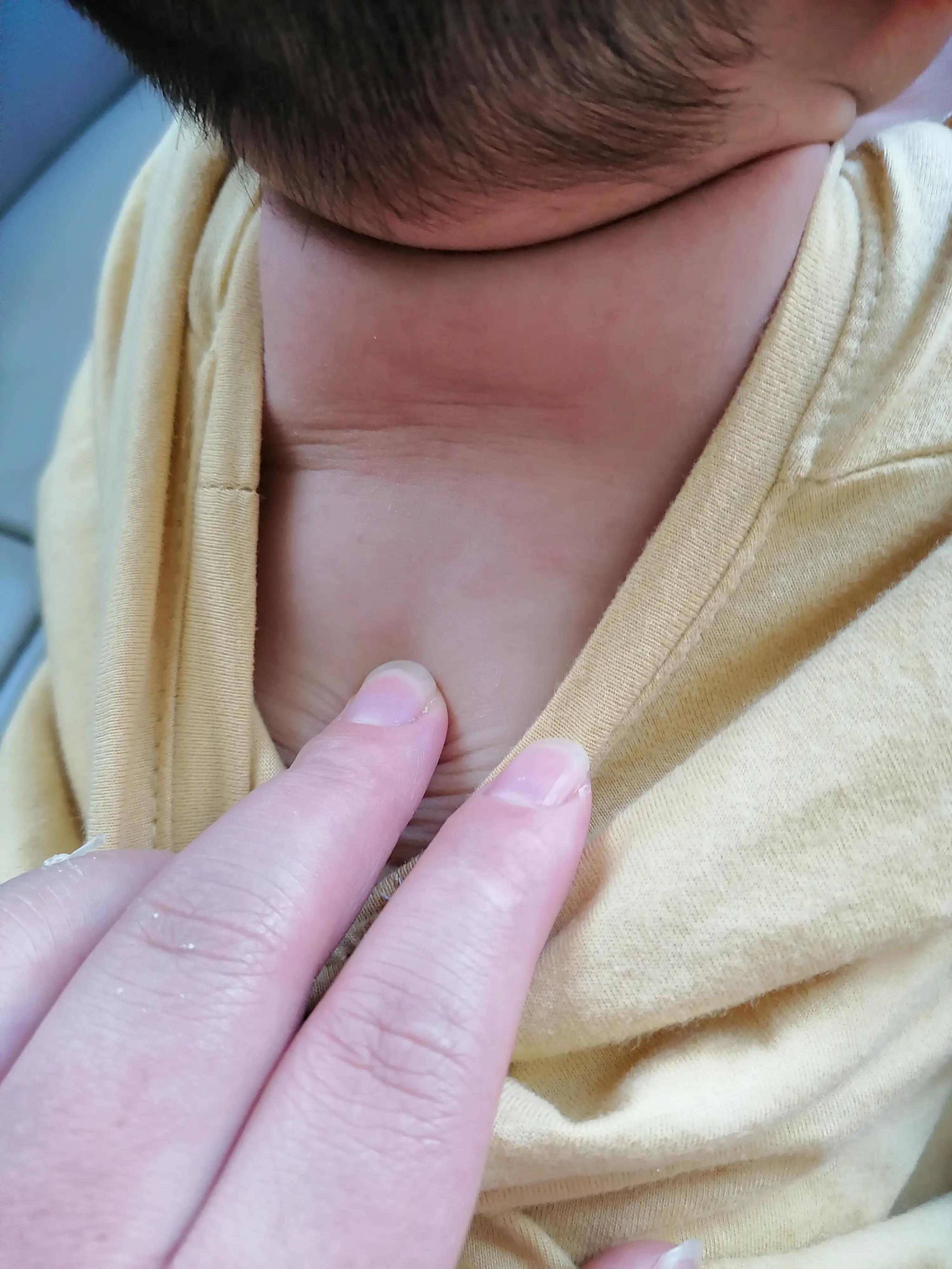 宝宝急疹一般几天痊愈,9个月宝宝幼儿急疹高热怎么喂药