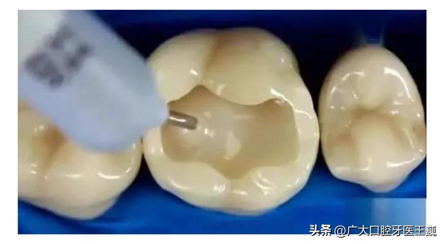 口腔科普出现问题,口腔科普牙齿松动了拔还是不拔