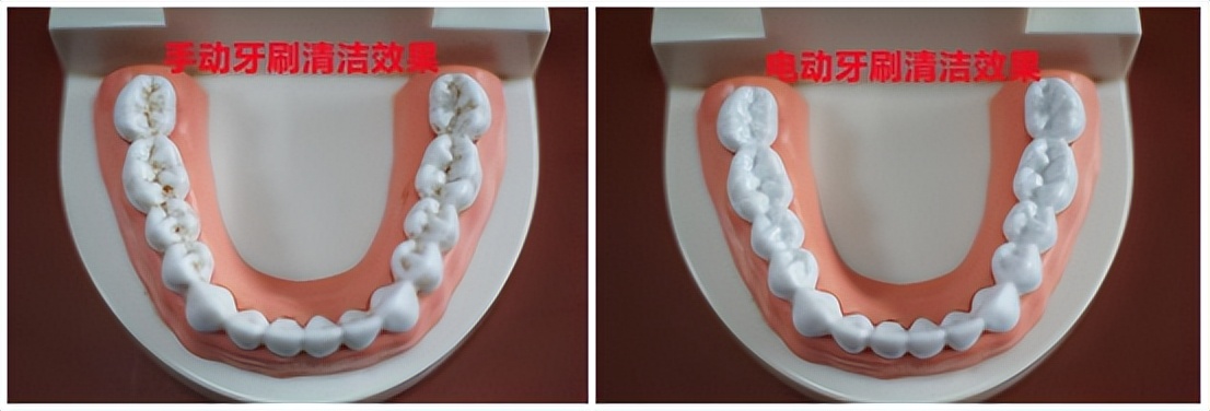 儿童电动牙刷的好处与危害有哪些,儿童电动牙刷的好处与坏处