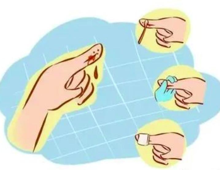 儿童外伤医生处理视频,小儿常见手部外伤的正确处理