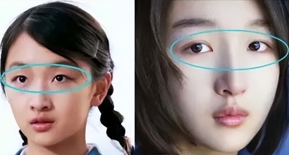 最近哪个明星割双眼皮前后对比,明星一般都做什么样的双眼皮