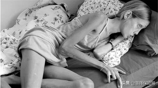 把50cm管子插入身体，每天上瘾，这件事正毁掉5万人