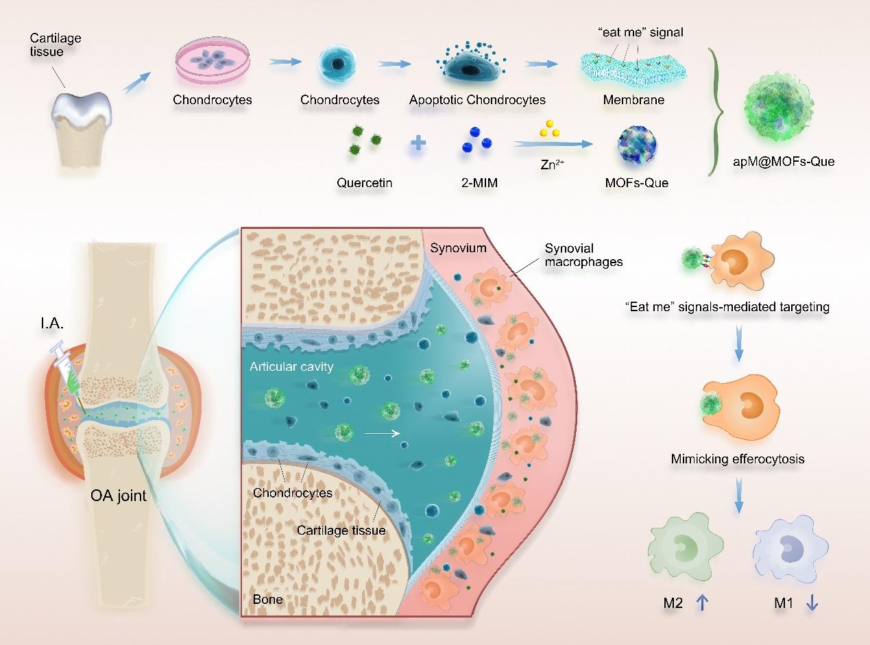 骨关节炎诊治要点及研究进展,骨性关节炎最新研究成果