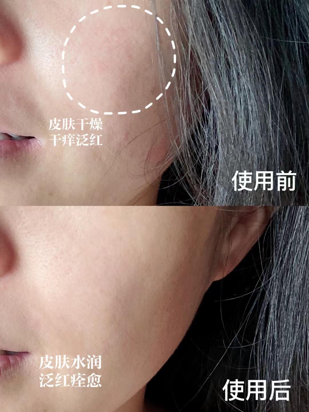 女性适合用哪种抗皱精华,50岁女人适合哪个品牌的精华液