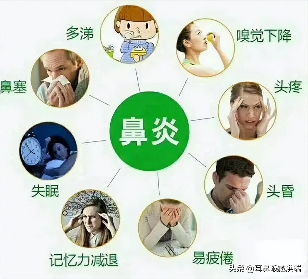 薄荷滴鼻液能治疗鼻炎吗,薄荷油滴鼻液能治疗过敏性鼻炎吗