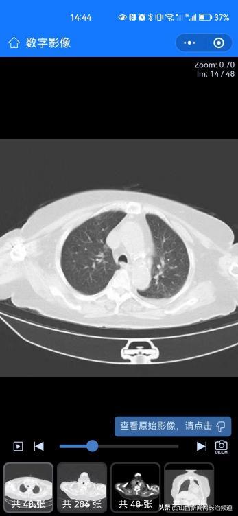 和平医院：“云胶片”上线影像报告扫码就可看