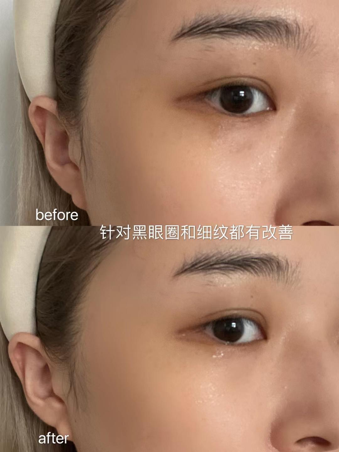 眼霜搓泥好还是不搓泥好,眼霜涂脸还是硅霜涂脸好