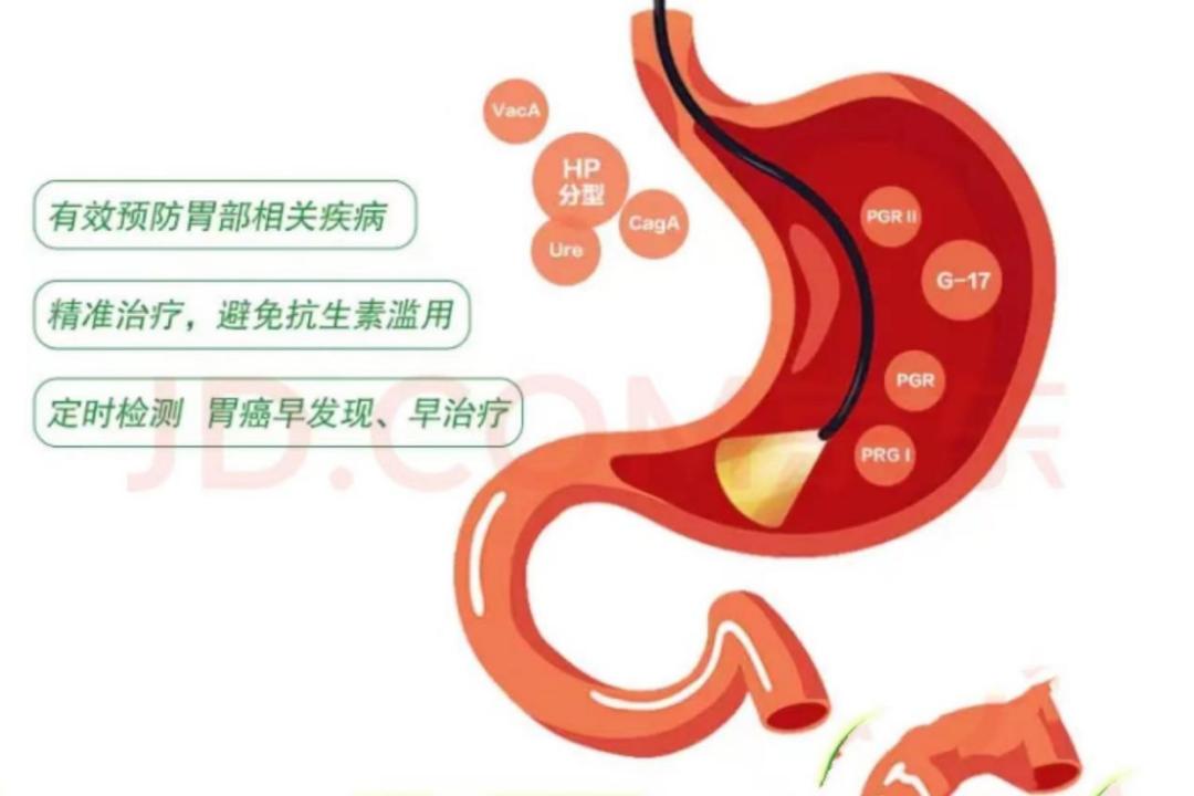 我用亲身经历告诉你无痛胃肠镜,无痛胃肠镜检查不再望镜生畏