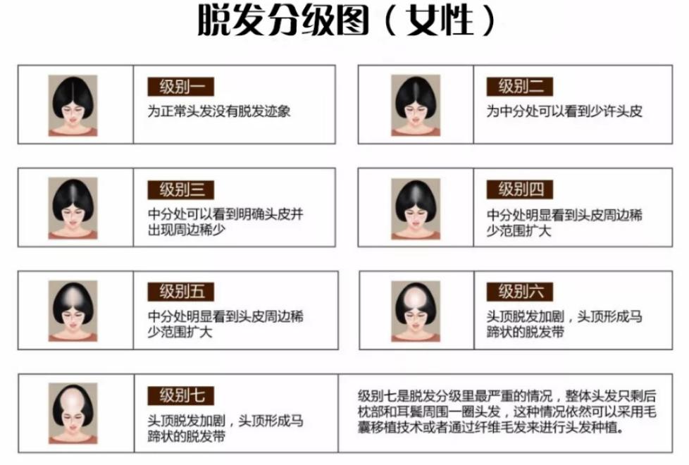 7种常见的脱发原因你是哪一种,脱发怎么办预防脱发看这里