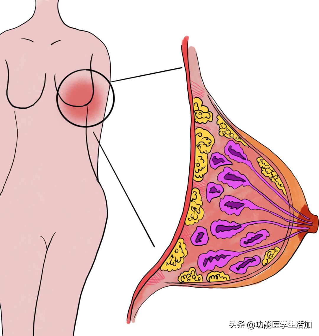 乳腺增生治疗费用大概多少,乳腺增生和囊肿需要治疗吗