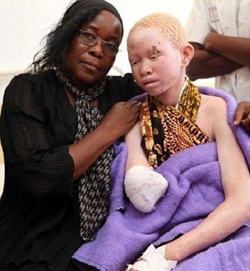 非洲版唐僧：血液堪比钻石，躯干价值126万元，警方24小时守卫