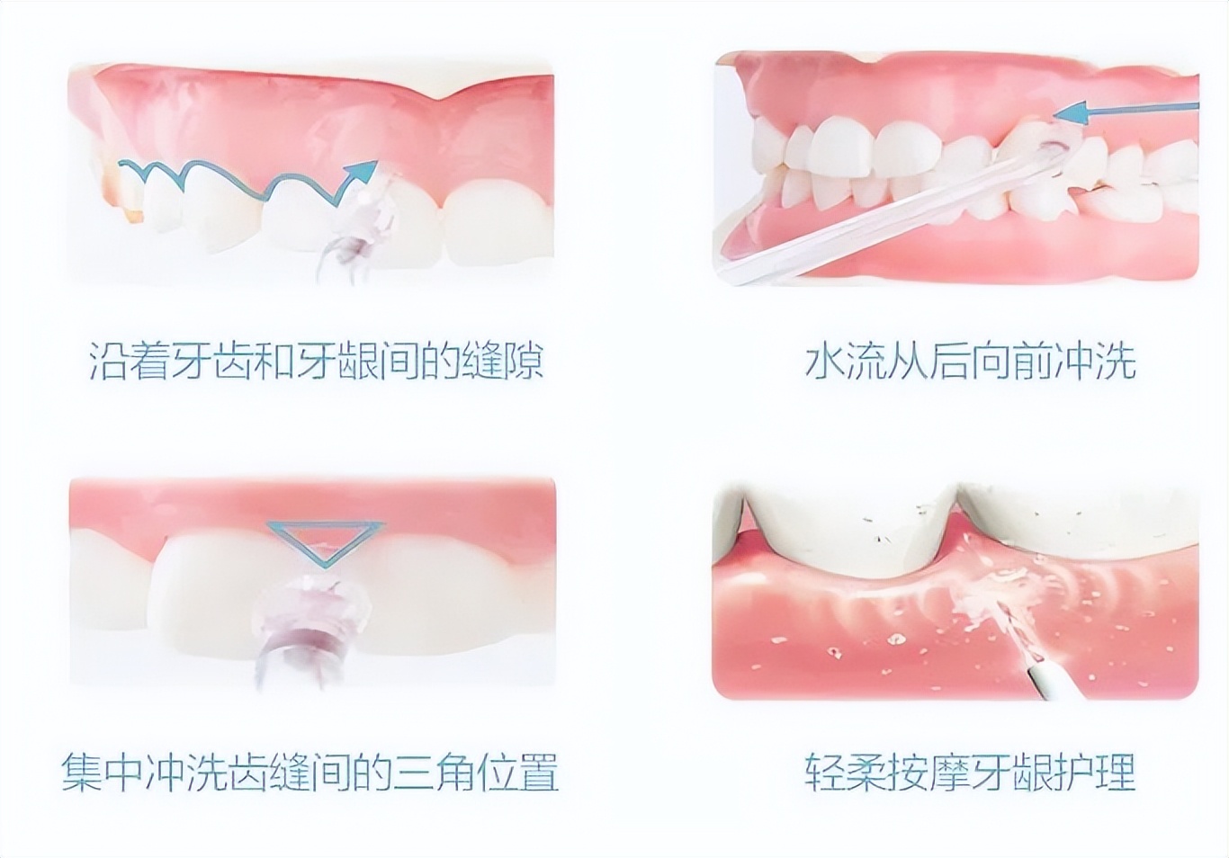 冲牙器和电动牙刷哪个效果好视频,电动牙刷冲牙器对比
