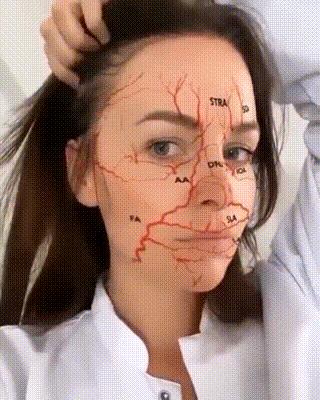 鼻基底玻尿酸栓塞后续治疗方法,鼻基底打玻尿酸栓塞后打溶解酶