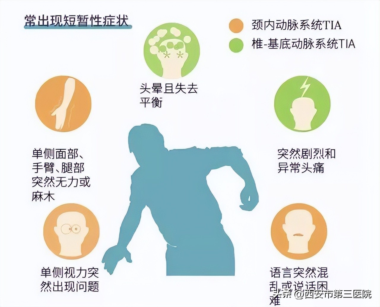 脑健康科普案例,脑卒中健康科普3分钟素材