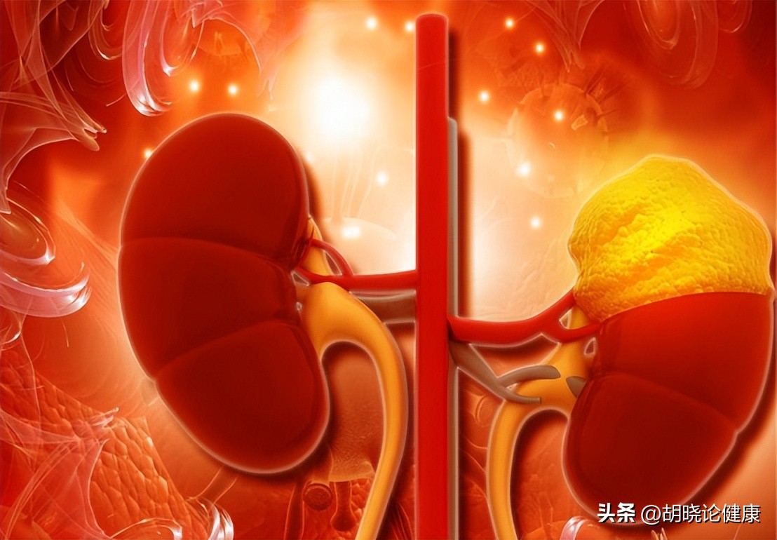 狼疮肾炎补体c4低是狼疮复发吗,狼疮性肾炎诊断的特异性抗体指标