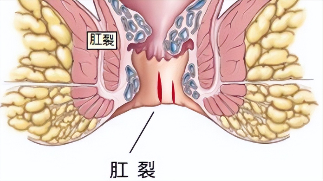 你有洗屁股的习惯吗,你有洗屁屁的习惯吗