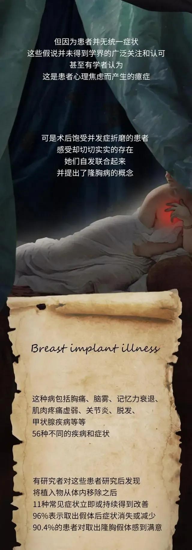 第一个隆胸的女人,全球最红隆胸女人