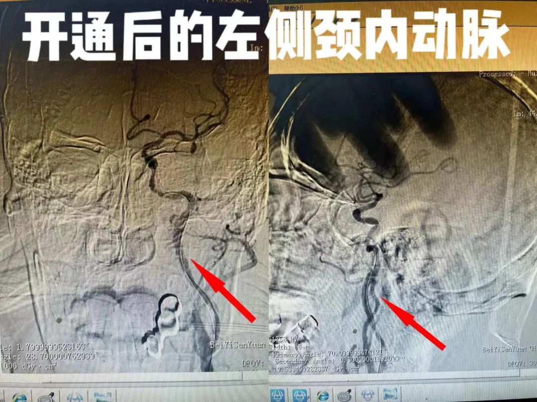 北医三院急诊抢救室,北医三院急救中心