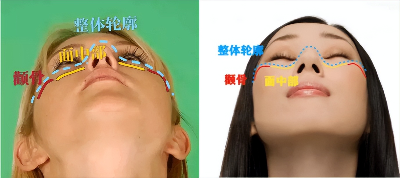 扁平脸影响美感,扁平头会对颜值有影响吗