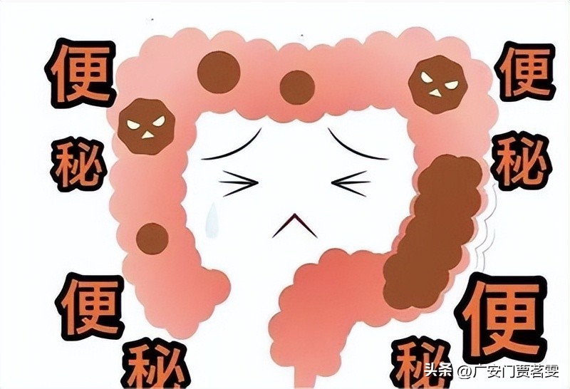 便秘的时候不要只吃香蕉，6款通便“神器”助你摆脱便秘