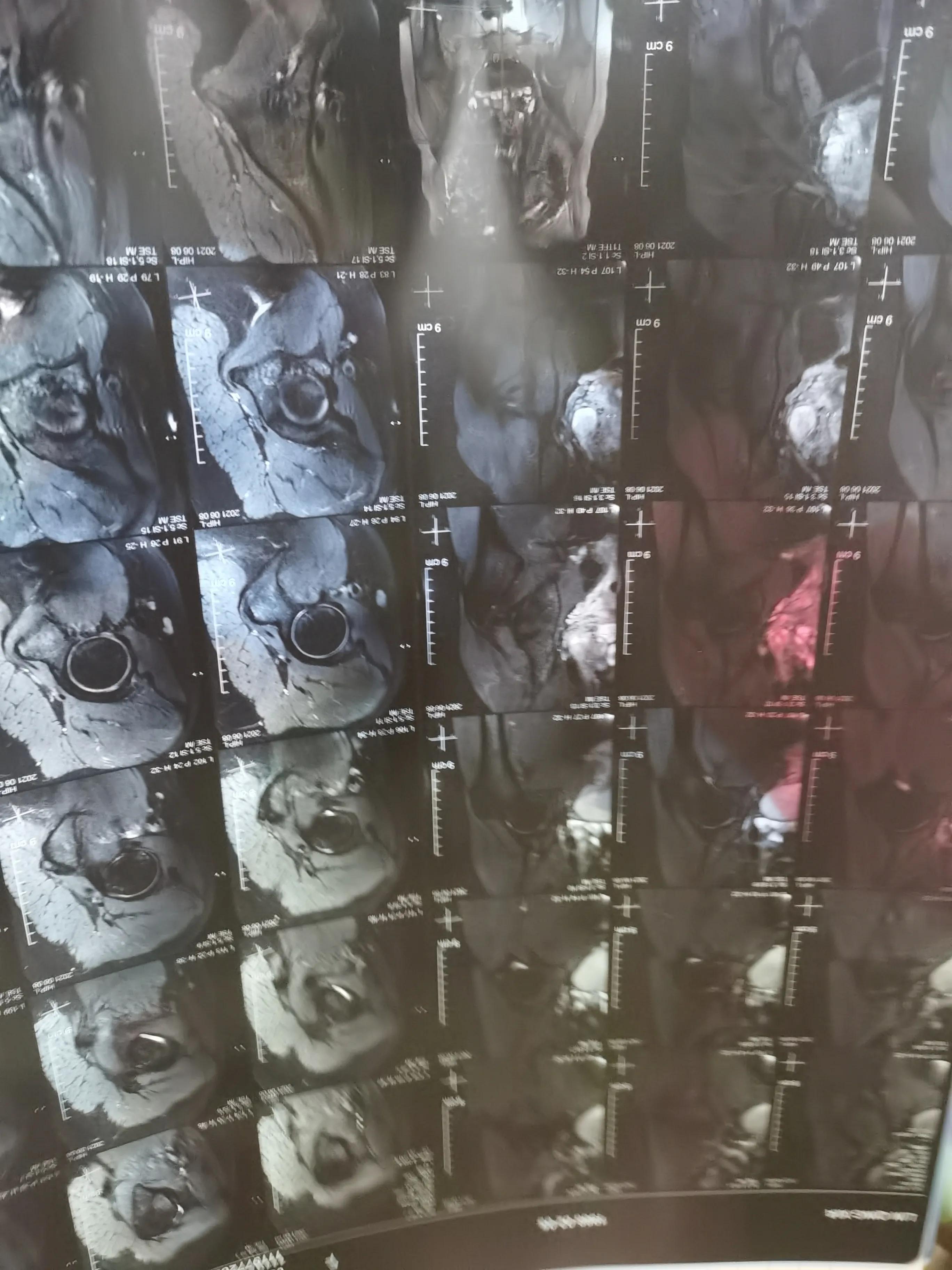 康复科真正的打开方式了解一下,康复科是个神奇的地方