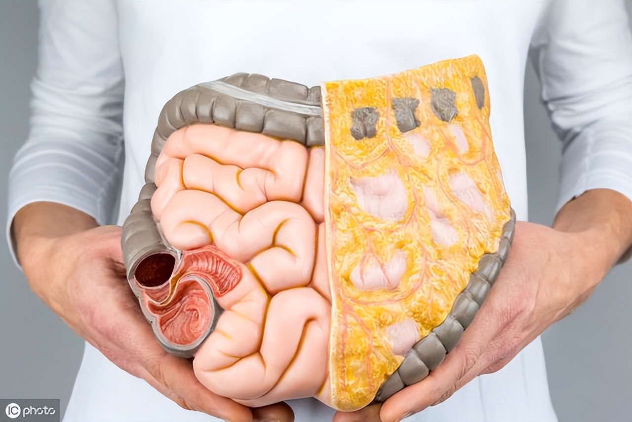 肠道清洁的目的,清洁肠道最干净的方法