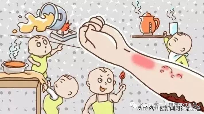 长治开水烫伤哪里治好,关于烧烫伤的不正确处理方式