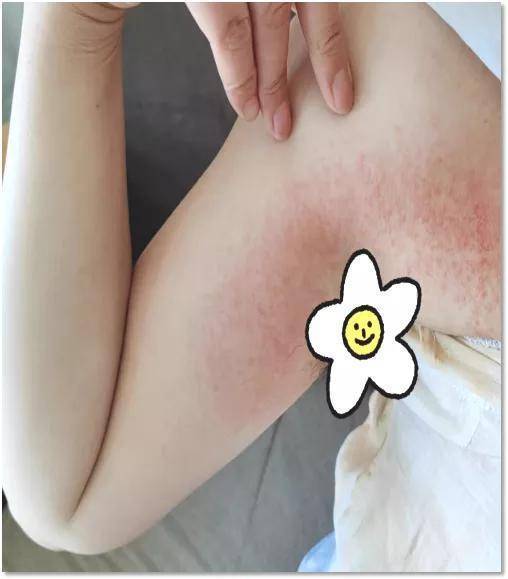 狐臭止汗露推荐不显黑,狐臭止汗露推荐真实测评怎么用