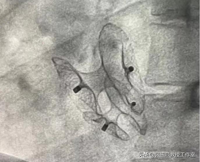 咳嗽不停该咋办导致晕厥,反复咳嗽一个月了是什么原因