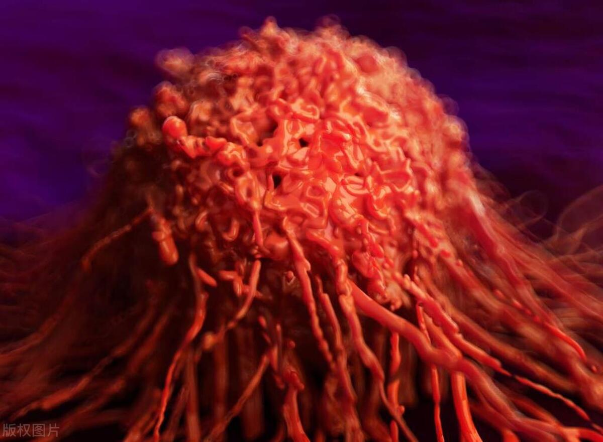 女朋友宫颈癌要分手吗,宫颈癌切除5年了