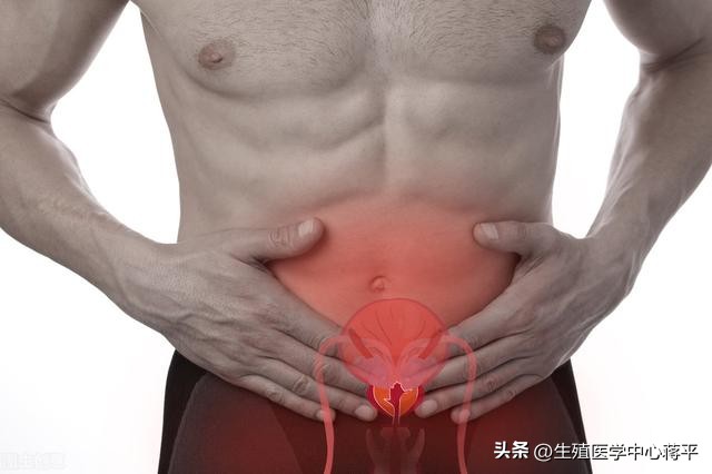 切勿忽视前列腺液检查，其对前列腺炎的诊断与治疗意义重大