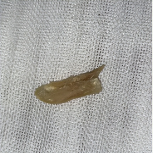 上海五官科医院朱雅颖医生,复旦大学附属耳鼻喉医院朱雅颖