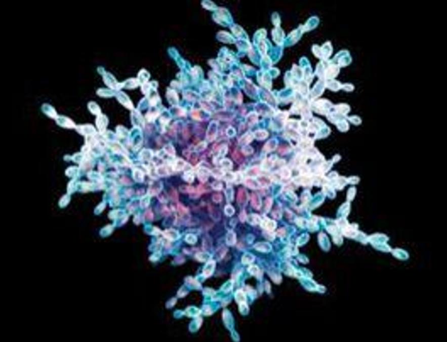 最可怕的朊病毒是什么,世界上最可怕的朊病毒