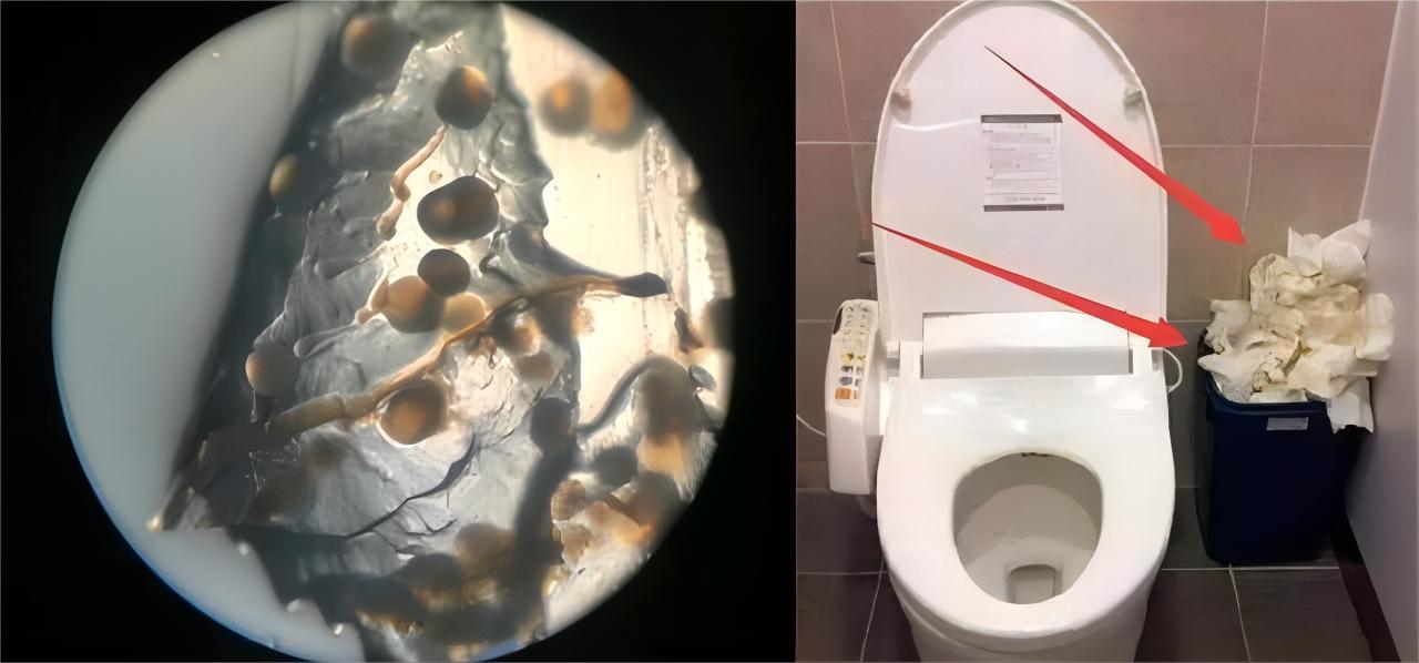 日本上完厕所的纸能丢进马桶吗,日本厕纸应该冲走还是放纸篓