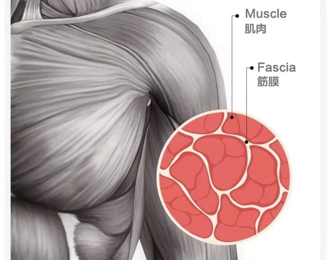 肌肉粘连会咔咔响吗,肌肉一摁有疼痛感