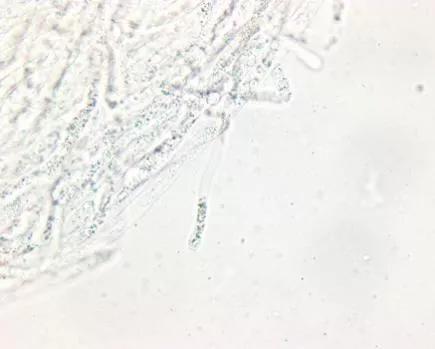 水产养殖霉菌怎么处理,水产养殖杀水霉方法