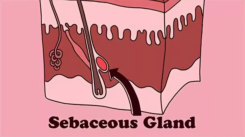 脸上疙疙瘩瘩但不是闭口,脸上疙疙瘩瘩是闭口吗