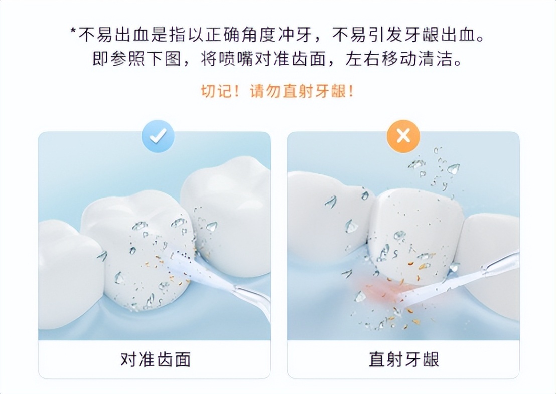 冲牙器测评实验室,冲牙器洁碧拜尔