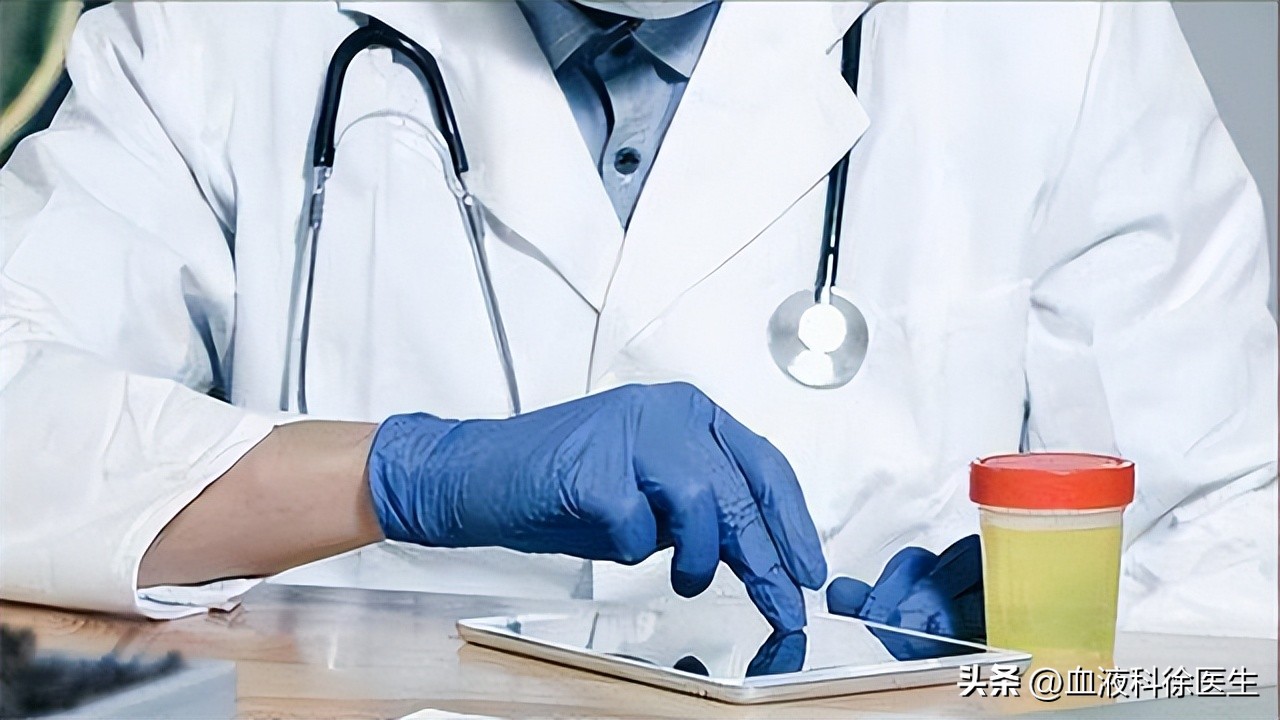 胆管癌的早期4大症状是什么呢,发现胆管癌要注意这4点