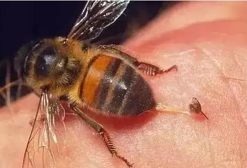 蜂蜇伤如何处理,蜂蜇伤最佳处理方法